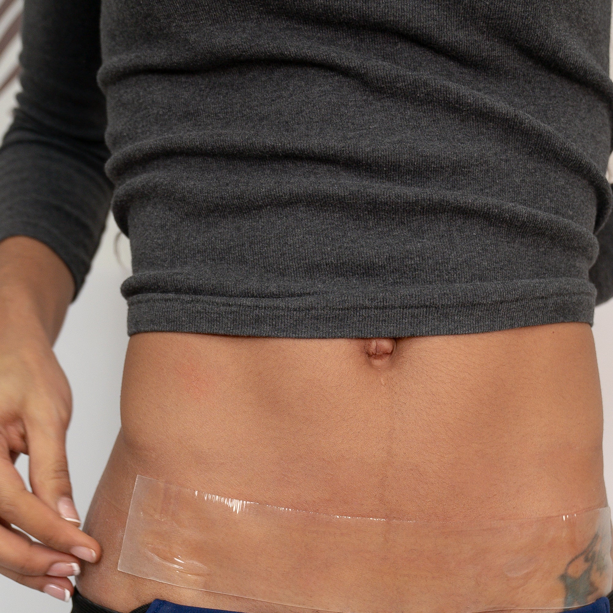 Silicone sheeting scar shield abdomen roll on the body